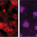 Brain cells in a mouse after a traumatic brain injury