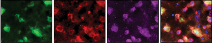 Brain cells in a mouse after a traumatic brain injury