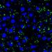 Tumor cell-derived EVPs induced accumulation of lipid droplets in the mouse liver. Green, lipid droplet. Blue, DAPI.