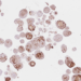 HNC organoids