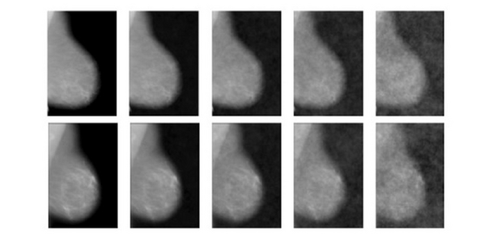 Influence of visual hindsight bias in mammogram reading.