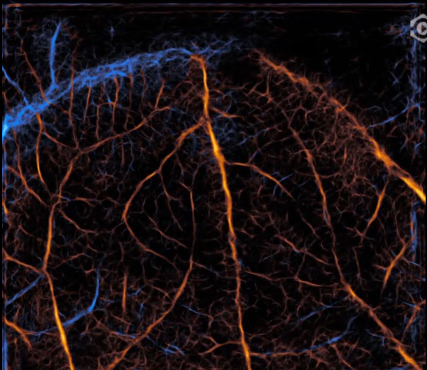 Ultrafast ultrasound video