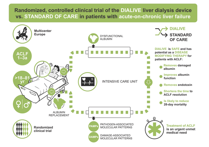 New liver dialysis device shows potential to resolve liver failure in patients with acute-on-chronic liver failure