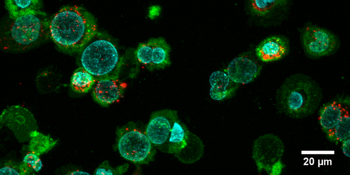 Extracellular vesicles