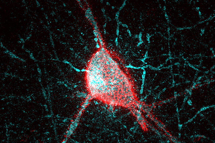 Parvalbumin interneuron surrounded by the perineuronal net