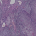 Histological Image