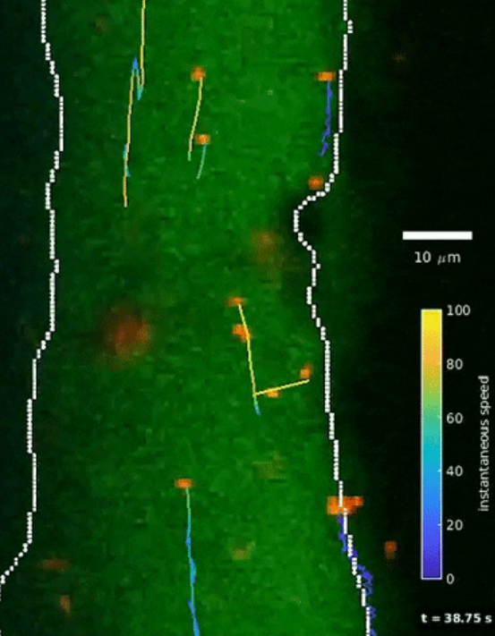 Particle tracking and PVS boundaries in Plane A