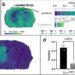 Spatial metabolomics images of a brain with a tumor.