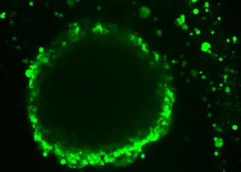 Fluorescent Dye Uptake in Ovarian Cancer Model