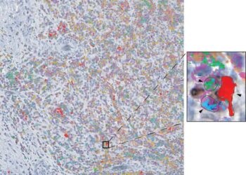 Immune Cell Interactions in Tumors