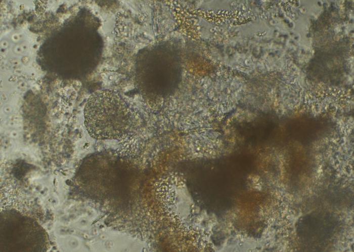 Cardiomyocytes in a petri dish - Garvan Institute