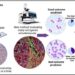 2023 0718 Novel approach predicting resistance against cancer therapy