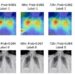 The proposed deep learning model utilizes chest x-ray radiography images to predict if a patient with COVID-19 will need intensive care within 24, 48, 72, and 96 hours after examination.