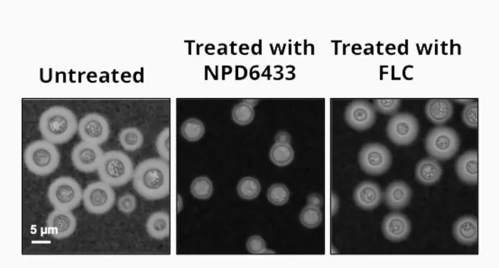 Blocking fatty acid synthesis kills dangerous fungi