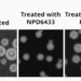 Blocking fatty acid synthesis kills dangerous fungi