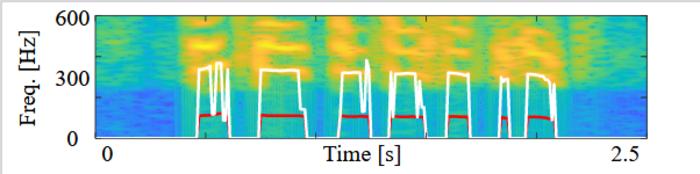 Diagnosis of voice condition from call audio - BIOENGINEER.ORG
