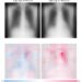 What the AI “sees” in a radiograph