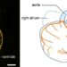 Latex-injected mouse heart.