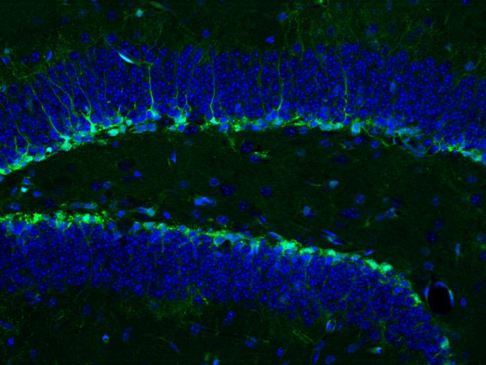 Neurogenesis