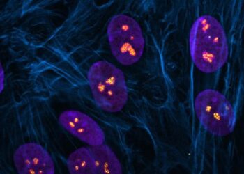 Fluorescent image showing cells with normal nucleoli in nuclei