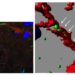 Figure 1  Fluorescent α-synuclein in the brain lymphatic system