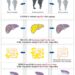 Abdominal fat plays important role in remission of prediabetes