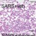 Lung histology - idroxonil