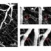 Bessel beam two-photon microscopy can be used to visualize capillaries in the brain. (Left) Maximum intensity projection to observe capillary stalling. (Right) Representative examples of different types of stalling events.