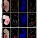 Humanized kidney cells