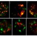 Elevated CXCL4 levels inhibit the TLR9 signaling pathway