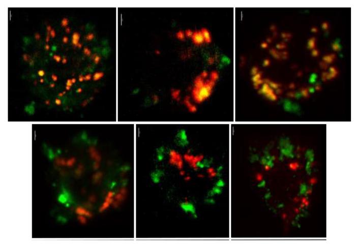 Elevated CXCL4 levels inhibit the TLR9 signaling pathway