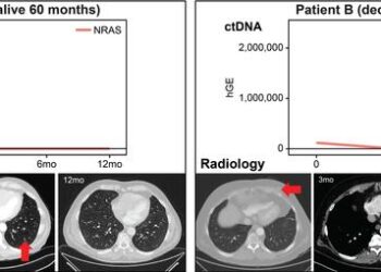Circulating tumor DNA (ctDNA) correlates with radiology disease assessment and patient outcome