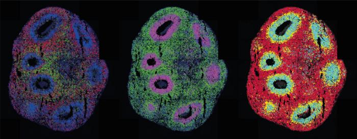 Human cerebral organoids