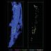 Minimally invasive longitudinal intravital imaging of cellular dynamics in the tibia