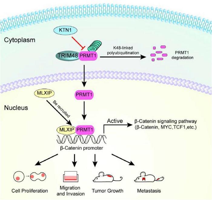 Schematic diagram showing PRMT1-enhanced gastric cancer metastasis mediated by the β-catenin signaling pathway in vitro and in vivo.