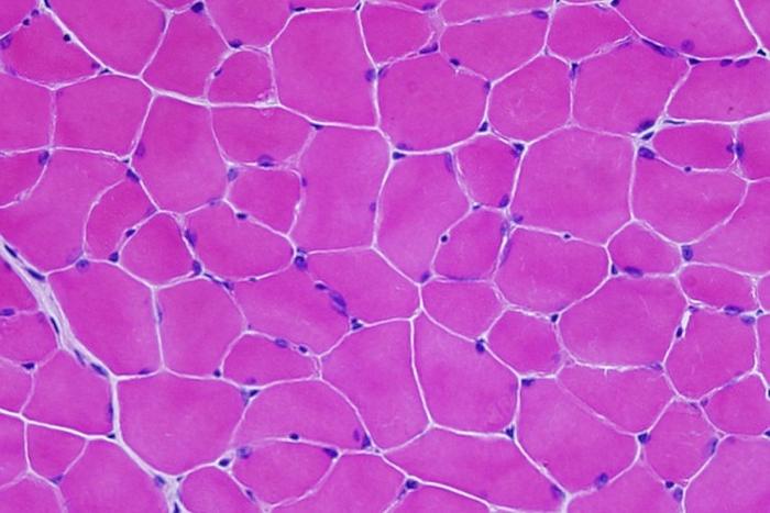 Mice with facioscapulohumeral muscular dystrophy show normal muscle fibers after treatment with a targeted gene therapy. Image courtesy of Nationwide Children’s Hospital.