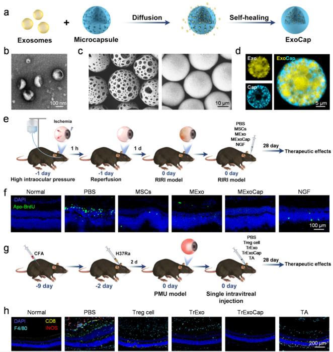 Construction of ExoCap and therapeutic effects of MExoCap or TrExoCap in RIRI or PMU mouse model, respectively