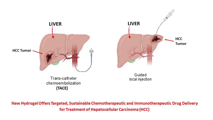 Enhanced Treatment of Liver Carcinoma with a Catheter-Administered or Injectable Drug-Eluting Hydrogel