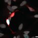 ASCL1 induces neurogenesis in human Muller glia