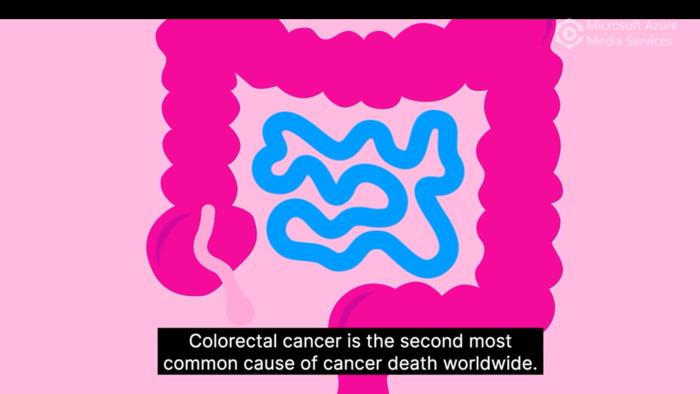 Explainer: MSIntuit CRC as an AI-based pre-screening tool for MSI detection from colorectal cancer histology slides