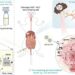 Self-fueling ferroptosis-inducing microreactors for transarterial ferro-embolization therapy