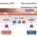 F. nucleatum and its impact on chronic rhinosinusitis (CRS).