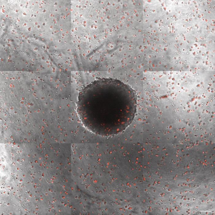 Macrophages (red) infiltrating a tumor spheroid