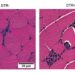 Immune cells mobilized during exercise counter exercise-induced inflammation