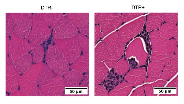 Immune cells mobilized during exercise counter exercise-induced inflammation