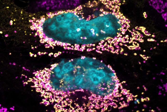 Study reveals bacterial protein capable of keeping human cells healthy