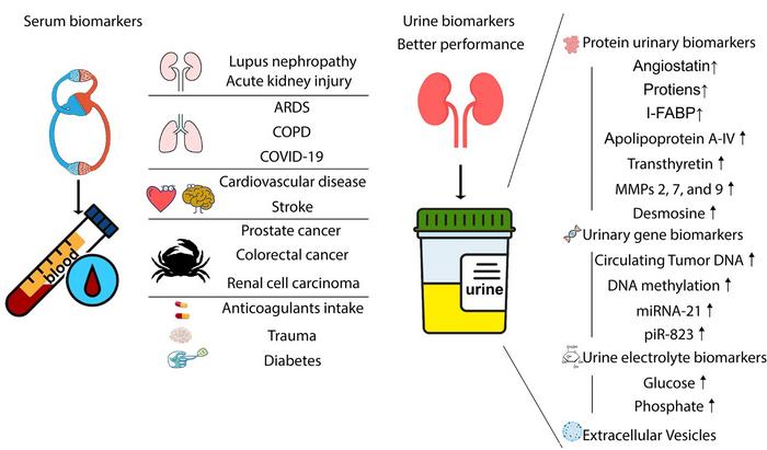 Urine biomarkers can outperform serum biomarkers in certain diseases