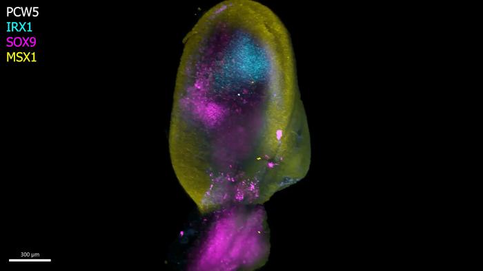 Video depicts gene expression clusters during limb development through spatial transcriptomic profiles and in situ staining of the tissue.