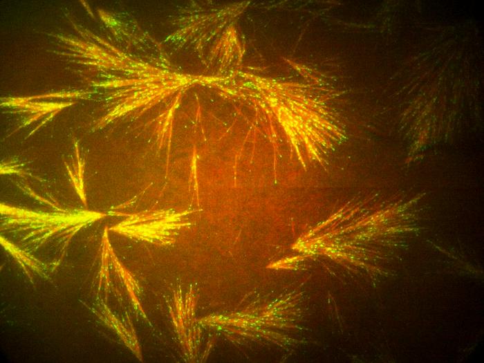 Cellular skeletons look like fireworks