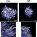 Treatment of aggressive breast cancer: discovery of a new protein involved in the development of metastases